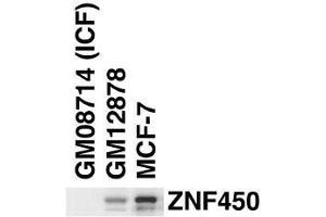 Image no. 3 for anti-Zinc Finger and BTB Domain Containing 24 (ZBTB24) (AA 137-166), (N-Term) antibody (ABIN655829)