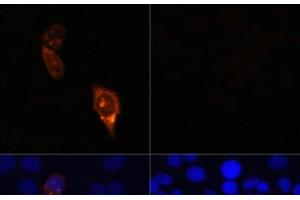 Immunofluorescence (IF) image for anti-CRISPR-Cas9 antibody (ABIN7008929)