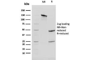 Image no. 1 for anti-Keratin 13 (KRT13) antibody (ABIN6939905)