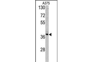 TALDO1 抗体  (AA 186-215)