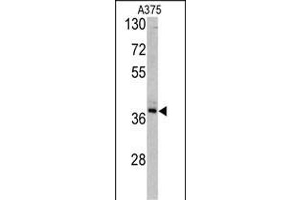 TALDO1 抗体  (AA 186-215)