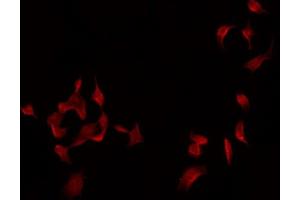 Image no. 1 for anti-Complement Factor I (CFI) (Internal Region) antibody (ABIN6257112)