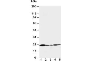 Image no. 3 for anti-Caveolin 1, Caveolae Protein, 22kDa (CAV1) (C-Term) antibody (ABIN3030337)