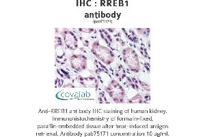 Image no. 1 for anti-Ras Responsive Element Binding Protein 1 (RREB1) antibody (ABIN1738965)
