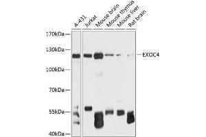 Sec8 anticorps  (AA 1-280)