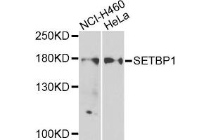 Image no. 1 for anti-SET Binding Protein 1 (SETBP1) antibody (ABIN2559891)