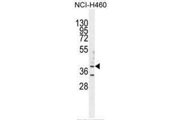 B3GALT5 Antikörper  (N-Term)