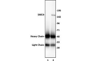 Image no. 2 for anti-Structural Maintenance of Chromosomes 4 (SMC4) (N-Term) antibody (ABIN6972758)