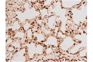 Image no. 13 for anti-Spleen tyrosine Kinase (SYK) (pTyr348) antibody (ABIN6255895)