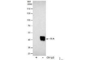 IP Image Immunoprecipitation of GLA protein from 293T whole cell extracts using 5 μg of Galactosidase alpha antibody [N1C2], Western blot analysis was performed using Galactosidase alpha antibody [N1C2], EasyBlot anti-Rabbit IgG  was used as a secondary reagent.
