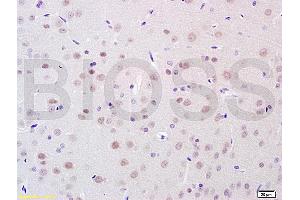 Image no. 1 for anti-POU Domain, Class 4, Transcription Factor 1 (POU4F1) (AA 325-419) antibody (ABIN702400)