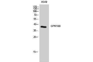Image no. 1 for anti-Relaxin/insulin-Like Family Peptide Receptor 4 (RXFP4) (C-Term) antibody (ABIN3184827)