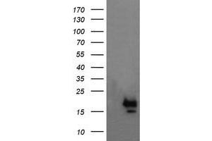 Image no. 1 for anti-NFKB Inhibitor Interacting Ras-Like 1 (NKIRAS1) antibody (ABIN1499743)