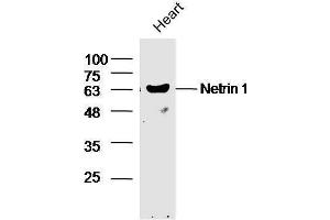Image no. 2 for anti-Netrin 1 (NTN1) (AA 501-604) antibody (ABIN735473)