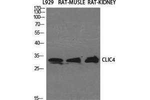 Image no. 2 for anti-Chloride Intracellular Channel 4 (CLIC4) (N-Term) antibody (ABIN3183954)