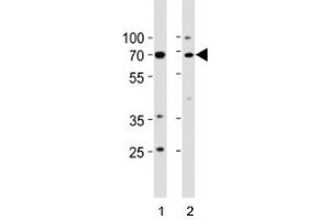 Image no. 6 for anti-Tumor Protein P73 (TP73) (AA 288-317) antibody (ABIN3029400)