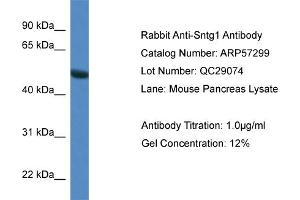 Image no. 1 for anti-Syntrophin, gamma 1 (SNTG1) (N-Term) antibody (ABIN2787161)