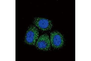 Image no. 1 for anti-Sodium Channel, Nonvoltage-Gated 1 alpha (SCNN1A) (Center) antibody (ABIN2502084)