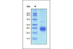Image no. 1 for Activin A Receptor Type II-Like 1 (ACVRL1) (AA 22-118) protein (His tag) (ABIN2180578)