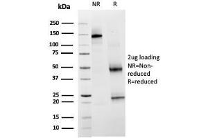 Image no. 1 for anti-Hepatitis A Virus Cellular Receptor 2 (TIM 3) (AA 22-202) antibody (ABIN6940963)
