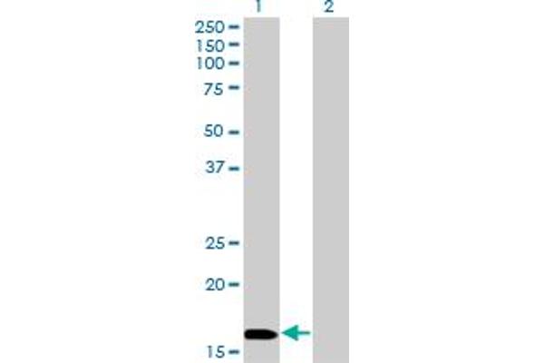 anti-NME/NM23 Nucleoside Diphosphate Kinase 3 (NME3) (AA 73-169) antibody