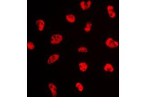Image no. 1 for anti-Nuclear Transcription Factor Y, alpha (NFYA) (C-Term) antibody (ABIN2705054)