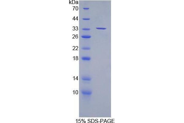 SUV420H2/KMT5C Protein
