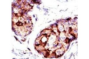 Image no. 3 for anti-Tumor Susceptibility Gene 101 (TSG101) (AA 1-30) antibody (ABIN3029402)