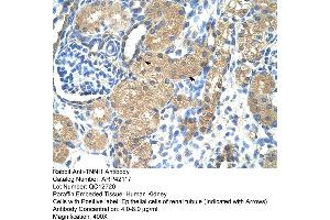 Image no. 2 for anti-Slow Skeletal Troponin I (TNNI1) (N-Term) antibody (ABIN2777151)
