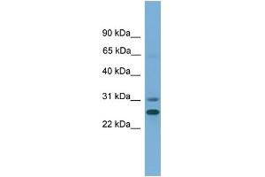Image no. 1 for anti-Dehydrogenase/reductase (SDR Family) Member 2 (DHRS2) (N-Term) antibody (ABIN2775324)