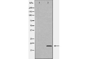 Image no. 1 for anti-Lymphocyte Antigen 96 (LY96) (Internal Region) antibody (ABIN6263029)