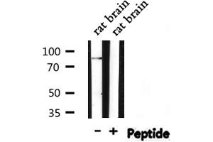 Image no. 6 for anti-Signal Transducer and Activator of Transcription 3 (Acute-Phase Response Factor) (STAT3) (pSer727) antibody (ABIN6256411)