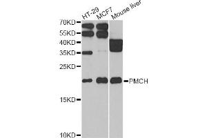 Image no. 2 for anti-Pro-Melanin-Concentrating Hormone (PMCH) antibody (ABIN2564591)