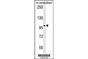 Image no. 1 for anti-Enhancer of Polycomb Homolog 2 (EPC2) (AA 205-233), (N-Term) antibody (ABIN651410)