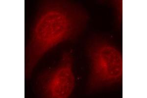 Image no. 1 for anti-Histone Deacetylase 8 (HDAC8) (pSer39) antibody (ABIN3020241)