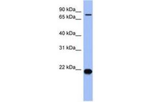 Image no. 1 for anti-Zinc Finger Protein 800 (ZNF800) (N-Term) antibody (ABIN6742935)