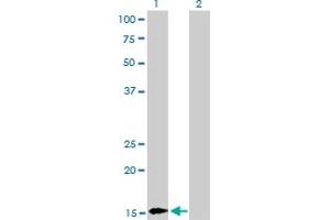 Western Blot analysis of BATF expression in transfected 293T cell line by BATF monoclonal antibody (M03), clone 1G4.