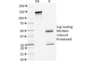 Image no. 1 for anti-Tryptase alpha/beta 1 (TPSAB1) (AA 115-233) antibody (ABIN6940799)