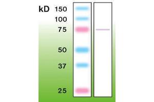 Image no. 3 for anti-Protein Kinase C, epsilon (PRKCE) antibody (ABIN870321)