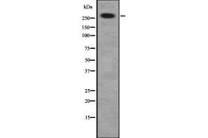 Image no. 1 for anti-Desmoplakin (DSP) (C-Term) antibody (ABIN6261374)