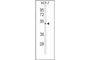 Image no. 3 for anti-Fibromodulin (FMOD) (AA 343-373), (C-Term) antibody (ABIN952324)