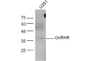 Image no. 5 for anti-Gonadotropin-Releasing Hormone Receptor (GNRHR) (AA 201-328) antibody (ABIN686917)
