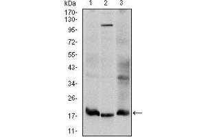 Image no. 1 for anti-Ubiquitin-Conjugating Enzyme E2I (UBE2I) antibody (ABIN969451)