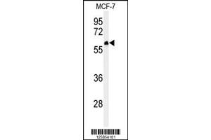 Western Blotting (WB) image for anti-Family with Sequence Similarity 20, Member A (FAM20A) antibody (ABIN2158771)
