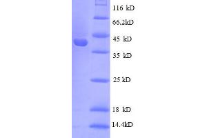 Image no. 1 for Ribosomal Protein S10 (RPS10) (AA 1-103), (full length) protein (GST tag) (ABIN5712610)