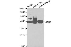 Image no. 3 for anti-Sorbitol Dehydrogenase (SORD) antibody (ABIN3022962)