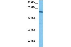 Image no. 2 for anti-Disabled Homolog 2, Mitogen-Responsive phosphoprotein (Drosophila) (DAB2) (N-Term) antibody (ABIN2777076)