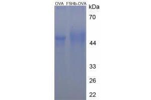 Image no. 2 for Follicle Stimulating Hormone, beta Polypeptide (FSHB) peptide (Ovalbumin) (ABIN5666179)