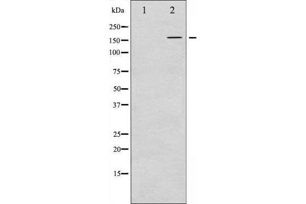anti-Fanconi Anemia, Complementation Group D2 (FANCD2) (pSer222) antibody