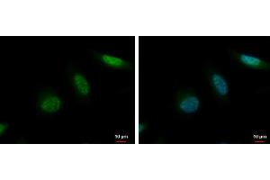 Image no. 2 for anti-Kinesin Family Member 2C (KIF2C) (Center) antibody (ABIN2855537)